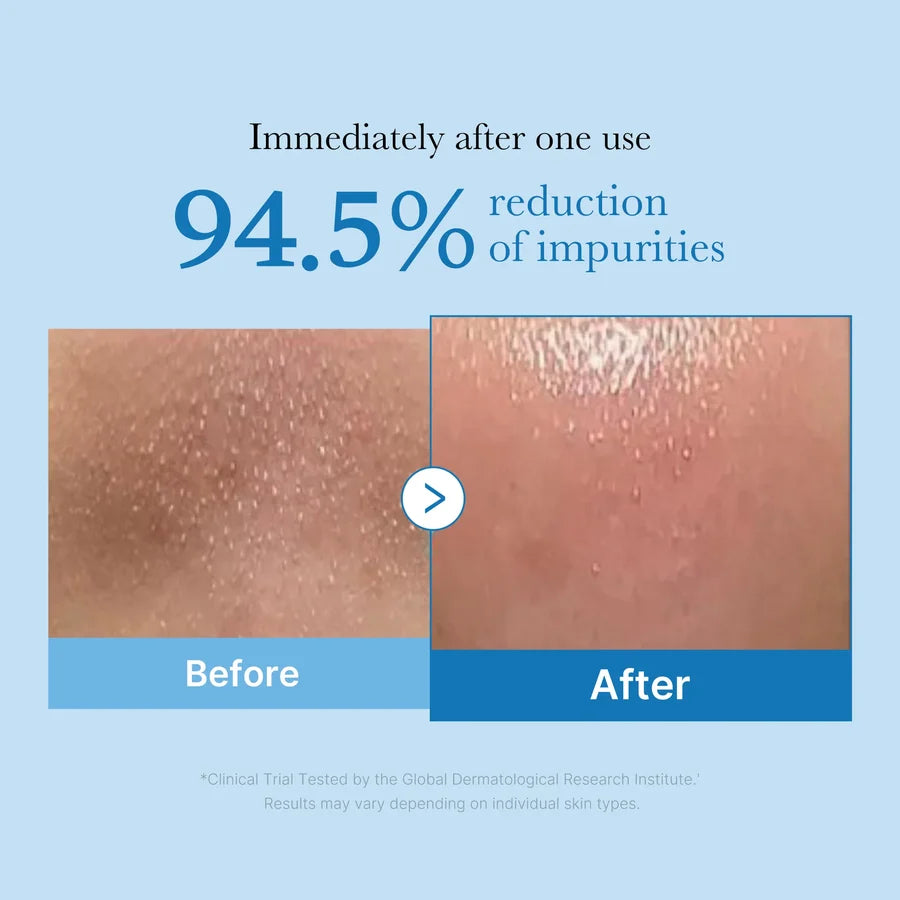 Medicube - Cleasing Oil Zero Pore