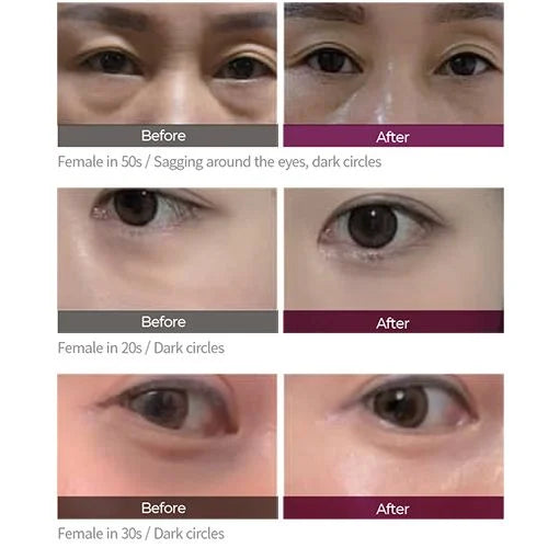 Dr Melaxin - Cemenrete Calcium Dark Spot Cover Eye Cream