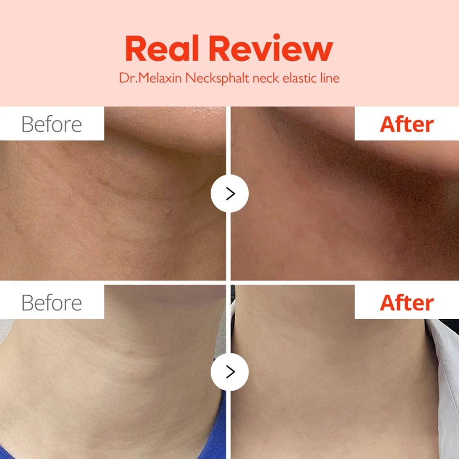 Dr Melaxin - Neckphalt ECM Ceramide Neck Cream